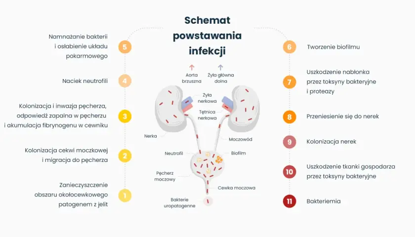 Schemat powstawania infekcji dróg moczowych, wyjaśniający, czy zapalenie pęcherza jest zaraźliwe. Pokazuje drogę bakterii od jelit do nerek.